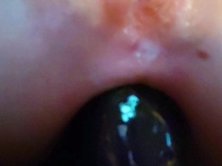 Anal fetish slut ass toyed